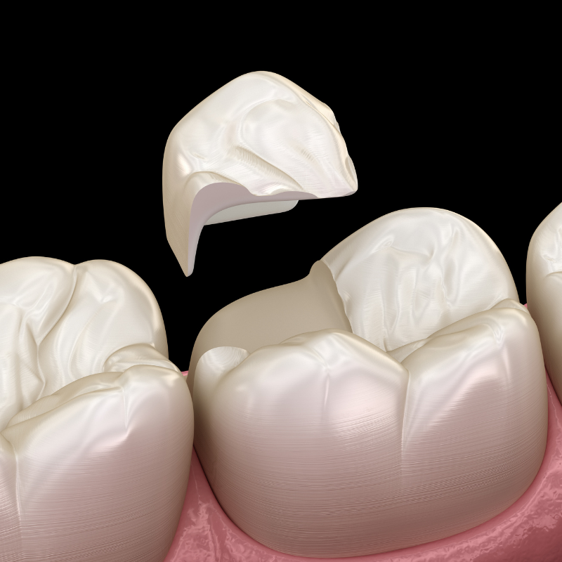 Fort Dental Center